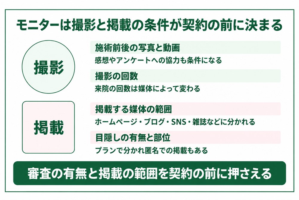 京都の医療ダイエットのモニターで先に決まる撮影と掲載の条件を整理した図