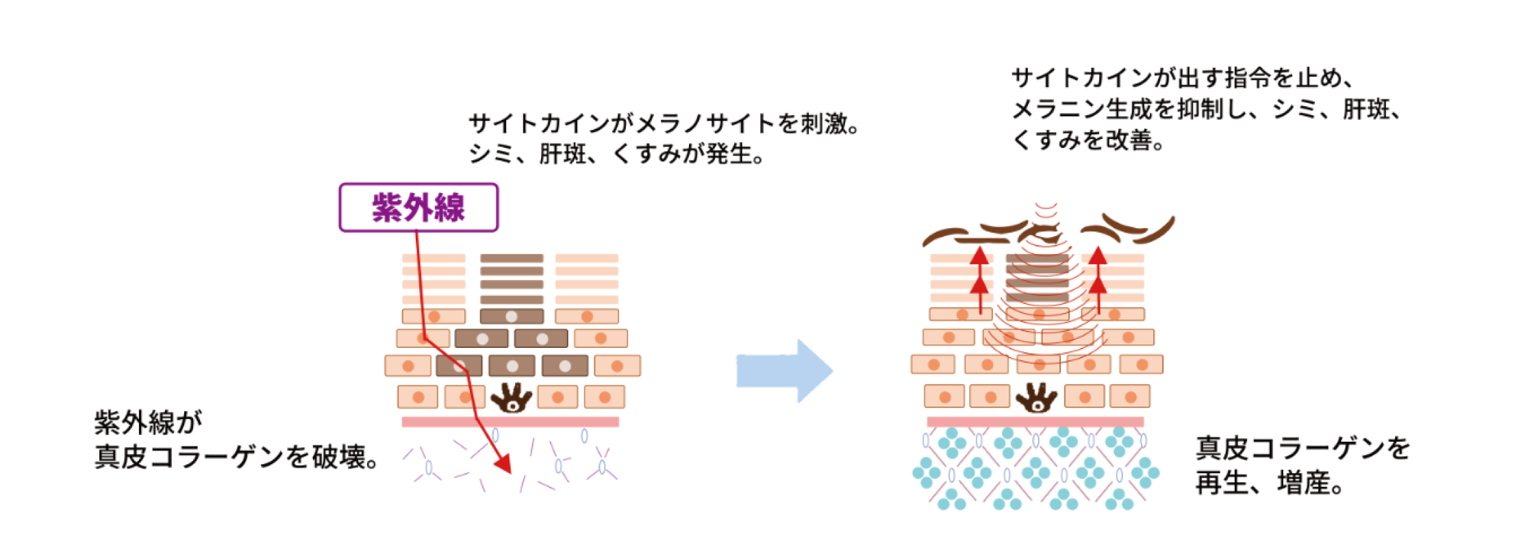 「シミ」ってどうやってできるの？